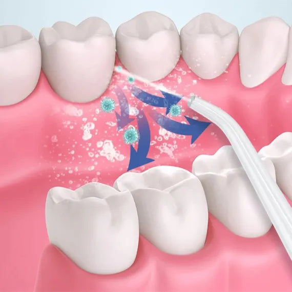 Dus(irigator) bucal si oral engross, 140 PSI, Functie masaj, rotatie 360°, portabil